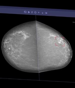 ai-mammogram-2.jpg